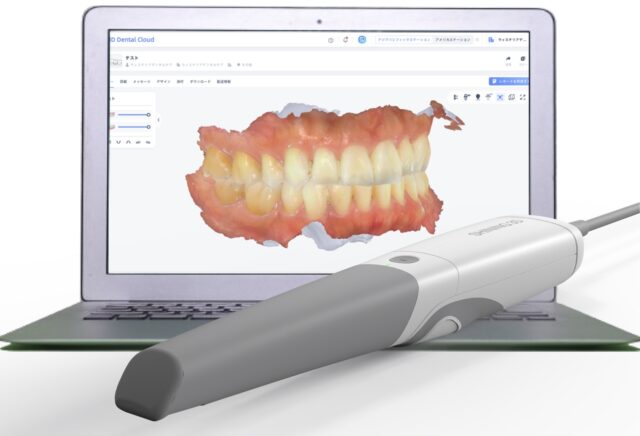 3D検診で見える化するお口の健康